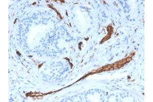 Formalin-fixed, paraffin-embedded human prostate stained with CD31 Mouse Monoclonal Antibody (PECAM1/3528).