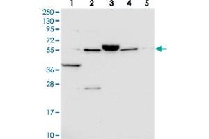 Western blot analysis of Lane 1: RT-4, Lane 2: U-251 MG, Lane 3: Human Plasma, Lane 4: Liver, Lane 5: Tonsil with C10orf129 polyclonal antibody . (C10ORF129 anticorps)