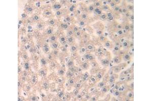 IHC-P analysis of Human Tissue, with DAB staining. (FRS2 anticorps  (AA 239-449))