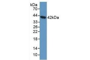 Detection of AGA in Human 293T Cells using Polyclonal Antibody to Aspartylglucosaminidase (AGA)