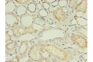 Immunohistochemistry of paraffin-embedded human kidney tissue using ABIN7174641 at dilution of 1:100 (UGT2B4 anticorps  (AA 281-481))