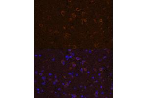 Immunofluorescence analysis of mouse spinal cord using CNTF Rabbit pAb (ABIN3015704, ABIN3015705, ABIN3015706 and ABIN6219054) at dilution of 1:100 (40x lens).