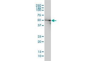 DDX6 monoclonal antibody (M01), clone 3D2 Western Blot analysis of DDX6 expression in Hela . (DDX6 anticorps  (AA 1-483))