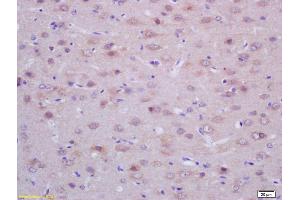 Formalin-fixed and paraffin embedded rat brain labeled with Rabbit Anti ACTH (18-39) Polyclonal Antibody, Unconjugated (ABIN668661) at 1:200 followed by conjugation to the secondary antibody and DAB staining (ACTH anticorps  (AA 18-39))