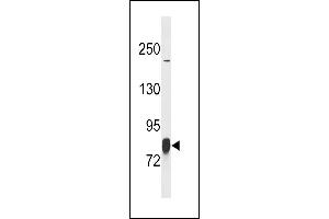 LIMK1 Antibody (T9) (ABIN392258 and ABIN2841942) western blot analysis in SK-BR-3 cell line lysates (35 μg/lane). (LIM Domain Kinase 1 anticorps  (N-Term))
