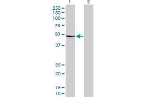Western Blot analysis of PAX6 expression in transfected 293T cell line by PAX6 MaxPab polyclonal antibody. (PAX6 anticorps  (AA 1-422))