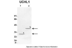 Sample Type: 1. (UCHL1 anticorps  (C-Term))