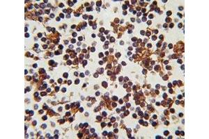 IHC analysis of FFPE human lymph tissue stained with FOXP3 antibody