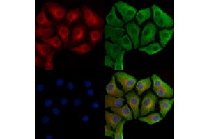 Phospho-Hexokinase 1 (Tyr732) Antibody staining Hela cells(heat shock treatment) by IF/ICC. (Hexokinase 1 anticorps  (pTyr732))