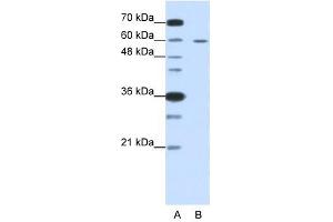 Western Blot showing FZD5 antibody used at a concentration of 1-2 ug/ml to detect its target protein. (FZD5 anticorps)