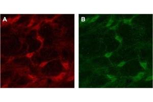 Expression of p75NTR in rat brain - Immunohistochemical staining of rat brain with Anti-p75 NGF Receptor (extracellular) Antibody (ABIN7043344, ABIN7044755 and ABIN7044756).