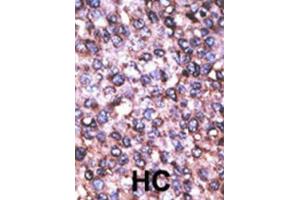Immunohistochemistry (IHC) image for anti-Melanoma Antigen Family D, 2 (MAGED2) antibody (ABIN3002534) (MAGED2 anticorps)