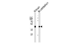 Western blot analysis of lysates from mouse brain and mouse cerebellum tissue lysate (from left to right), using ZDHHC14 Antibody (Center) (ABIN6243381 and ABIN6577546). (ZDHHC14 anticorps  (AA 283-317))