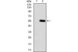 Western Blotting (WB) image for anti-Histone Deacetylase 9 (HDAC9) (AA 343-569) antibody (ABIN5867683)