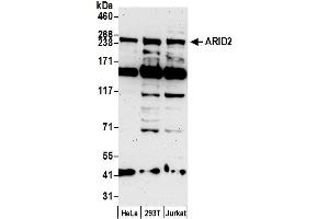 Western Blotting (WB) image for anti-AT Rich Interactive Domain 2 (ARID, RFX-Like) (ARID2) (AA 1600-1650) antibody (ABIN7452697)
