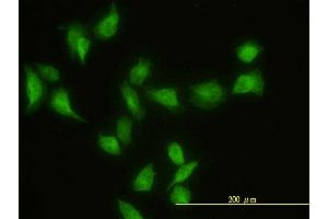 Immunofluorescence of monoclonal antibody to GIT2 on HeLa cell.