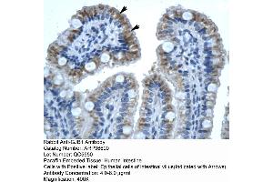 Human Intestine (GJB1 anticorps  (C-Term))