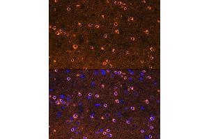 Immunofluorescence analysis of rat brain using CRMP2/DPYSL2 Rabbit mAb  at dilution of 1:100 (40x lens).