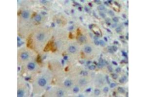 IHC-P analysis of Liver tissue, with DAB staining. (CD8B anticorps  (AA 22-175))