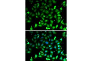 Immunofluorescence analysis of MCF-7 cells using RAE1 antibody (ABIN5974056). (RAE1 anticorps)