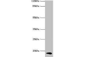 Western blot All lanes: CALML5 antibody at 2 μg/mL + A431 whole cell lysate Secondary Goat polyclonal to rabbit IgG at 1/10000 dilution Predicted band size: 16 kDa Observed band size: 16 kDa (CALML5 anticorps  (AA 2-146))