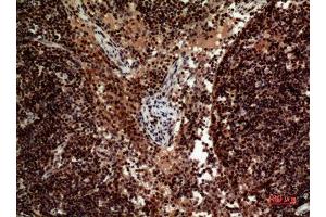 Immunohistochemistry (IHC) analysis of paraffin-embedded Human Lymph Nodes, antibody was diluted at 1:100. (TRAIL anticorps  (Internal Region))