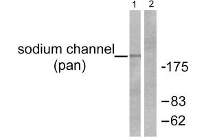 Western blot analysis of extracts from HuvEc cells, using Sodium Channel-pan Antibody (ABIN5976507). (Sodium Channel anticorps  (Internal Region, pan))