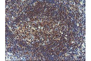 Image no. 1 for anti-Prefoldin Subunit 3 (PFDN3) antibody (ABIN1501704)