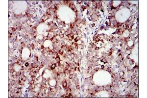 Immunohistochemistry (IHC) image for anti-Phosphoinositide 3 Kinase, p85 alpha (PI3K p85a) (AA 159-388) antibody (ABIN1844692)
