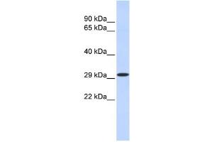Western Blotting (WB) image for anti-Kruppel-Like Factor 14 (KLF14) antibody (ABIN2458210) (KLF14 anticorps)