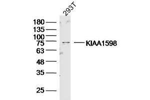 293T lysates probed with KIAA1598 Polyclonal Antibody, Unconjugated  at 1:300 dilution and 4˚C overnight incubation. (Shootin-1 (SHTN1) (AA 21-130) anticorps)