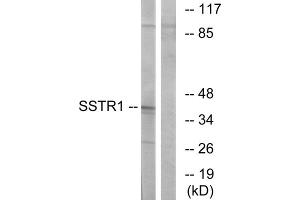 Western blot analysis of extracts from COS-7 cells, using SSTR1 antibody. (SSTR1 anticorps  (N-Term))