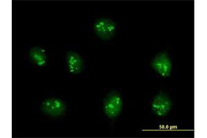 Immunofluorescence of purified MaxPab antibody to PDE9A on HeLa cell. (PDE9A anticorps  (AA 1-533))