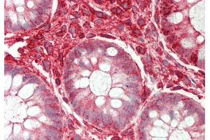 Rabbit Anti-ST3GAL4 antibody  Formalin Fixed Paraffin Embedded Tissue: Human Colon Primary antibody Concentration: 1:200 Secondary Antibody: Donkey anti-Rabbit-Cy3 Secondary Antibody Concentration: 1:200 Magnification: 20x Exposure Time: 0.