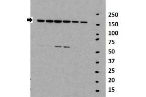 Researcher: Daolin Tang, University of Pittsburgh Medical Center Species+tissue/cell type: Lane 1-6: 30ug mouse MEF lysate Primary antibody dilution: 1:2000 (TNKS anticorps  (Middle Region))