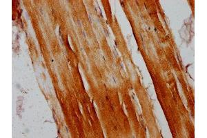 IHC image of ABIN7167086 diluted at 1:200 and staining in paraffin-embedded human skeletal muscle tissue performed on a Leica BondTM system.