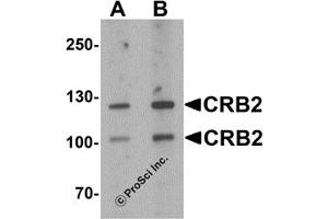 Western Blotting (WB) image for anti-Crumbs Homolog 2 (CRB2) antibody (ABIN1077416) (CRB2 anticorps)