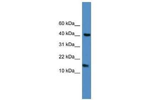 Western Blot showing LCN1 antibody used at a concentration of 1-2 ug/ml to detect its target protein.