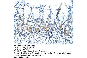 Rabbit Anti-ADAT1 Antibody  Paraffin Embedded Tissue: Human Stomach Cellular Data: Epithelial cells of fundic gland Antibody Concentration: 4. (ADAT1 anticorps  (C-Term))