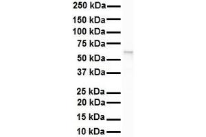 WB Suggested Anti-SNRP70 antibody Titration: 1 ug/mL Sample Type: Human Raji (SNRNP70 anticorps  (N-Term))