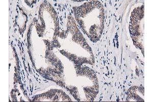 Image no. 1 for anti-Eukaryotic Translation Initiation Factor 4E Family Member 2 (EIF4E2) antibody (ABIN1497992) (EIF4E2 anticorps)