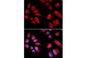Immunofluorescence analysis of U2OS cells using CBS antibody (ABIN5970665). (CBS anticorps)