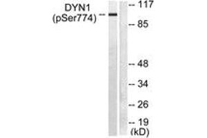 Western blot analysis of extracts from mouse brain, using Dynamin-1 (Phospho-Ser774) Antibody. (Dynamin 1 anticorps  (pSer774))