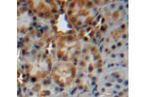 Used in DAB staining on fromalin fixed paraffin-embedded liver tissue (CYP24A1 anticorps  (AA 37-250))