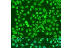 Immunofluorescence analysis of U2OS cells using NPR3 Polyclonal Antibody at dilution of 1:100. (NPR3 anticorps)