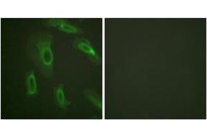 Immunofluorescence analysis of HeLa cells, using CD227/Mucin 1 (Ab-1243) Antibody.