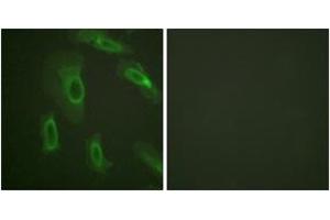 Immunofluorescence analysis of HeLa cells, using CD227/Mucin 1 (Ab-1243) Antibody. (MUC1 anticorps  (AA 1204-1253))