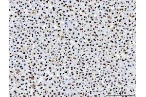 IHC analysis of PC4/SUB1 using anti-PC4/SUB1 antibody (ABIN7602185). (SUB1 anticorps  (AA 62-127))