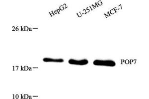Western blot analysis of POP7 (ABIN7075179),at dilution of 1: 1000 (POP7 anticorps)