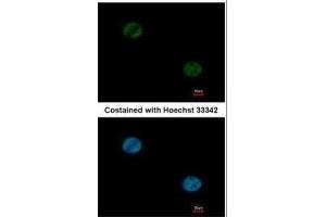 ICC/IF Image Immunofluorescence analysis of paraformaldehyde-fixed HeLa, using FOXA1, antibody at 1:1000 dilution. (FOXA1 anticorps  (C-Term))